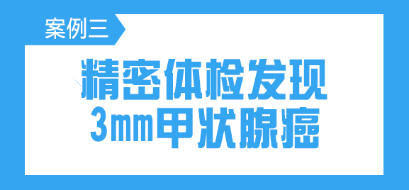 精密体检发现3mm甲状腺癌